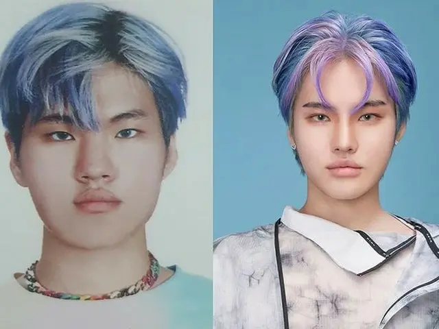 Rapper Takuwa và hình ảnh trước và sau khi phẫu thuật thẩm mỹ đã được phát hành.