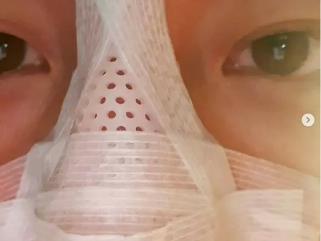 Nam diễn viên Shan Jung-soo tiết lộ trên SNS rằng anh bị gãy mũi khi chơi bóng r