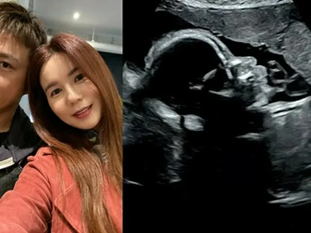 Nam diễn viên Kim Tae-hyun thông báo rằng trái tim của đứa trẻ trong vòng tay củ