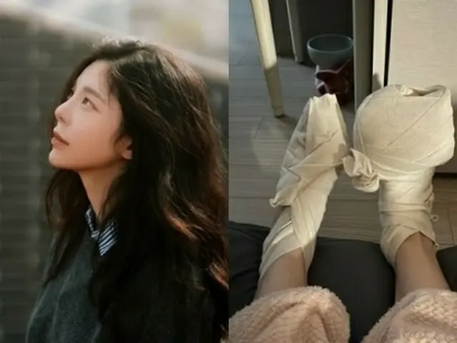 Ca sĩ Jang Jae-in tiết lộ rằng chân anh bị bỏng nặng. Đăng một bức ảnh của băng 