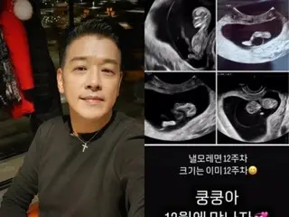 “Vợ 19 tuổi của tôi đang mang thai” Nam diễn viên Ryu Si Won tiết lộ siêu âm em bé “kunkun” ở tuần thứ 12
