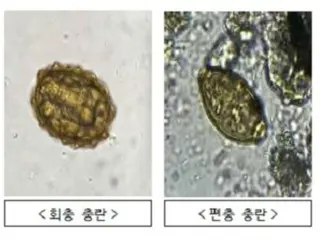 'Ký sinh trùng' được tìm thấy trong 'quả bóng bẩn' của Triều Tiên = Hàn Quốc