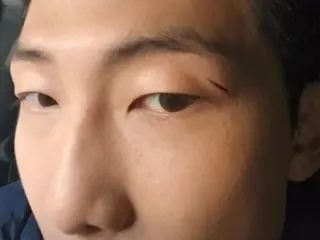 "BTS" RM lộ vết sẹo sâu trên khuôn mặt điển trai... vết sẹo đau đớn phía trên mắt